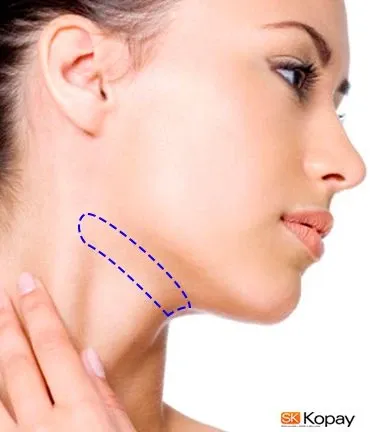 Extensión de Cuello